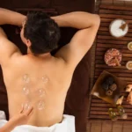 hijama cupping therapy