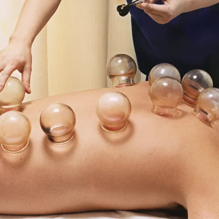 hijama pain relief Canada