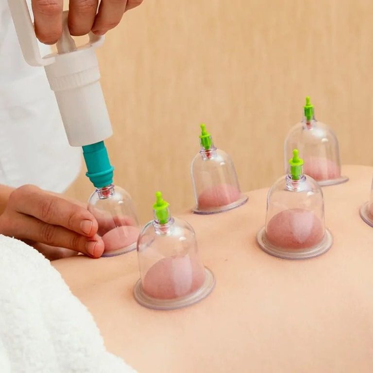 hijama-01